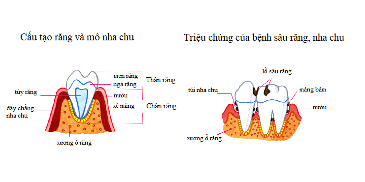 Bệnh tiểu đường và sức khỏe răng miệng 1